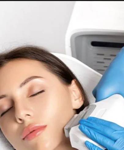 IPL Photofacial