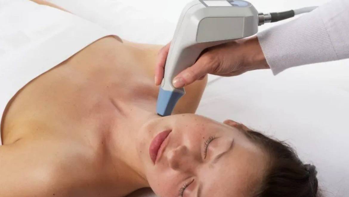 TempSure RF Treatments – Full Face