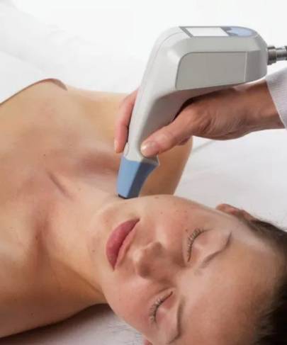 TempSure RF Treatments – Full Face