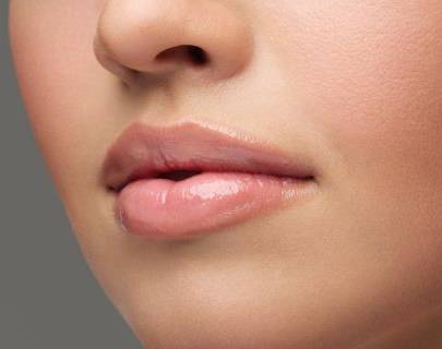 Juvéderm Derma Filler